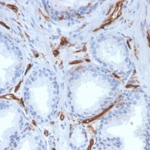 Formalin-fixed, paraffin-embedded human prostate stained with CD31 Mouse Monoclonal Antibody (PECAM1/3527).
