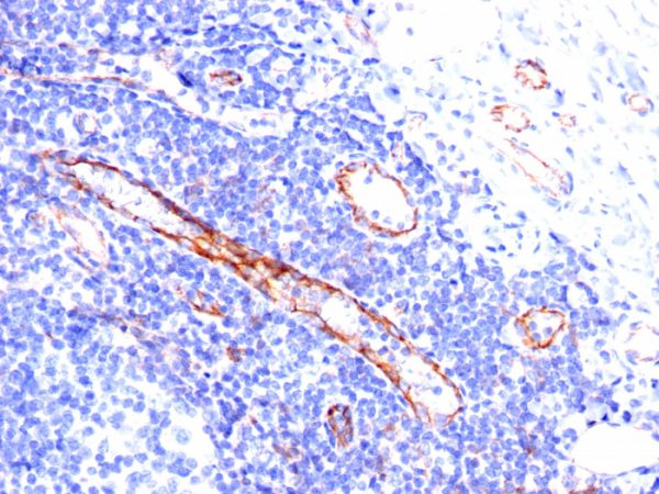 Formalin-fixed, paraffin-embedded human Tonsil stained with CD31 Mouse Monoclonal Antibody (C31.3).
