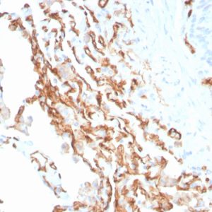 Formalin-fixed, paraffin-embedded human Colon stained with CD31 Mouse Monoclonal Antibody (PECAM1/3534).