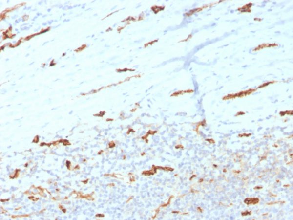 Formalin-fixed, paraffin-embedded human Tonsil stained with CD31 Mouse Monoclonal Antibody (PECAM1/3534).