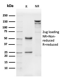 SDS-PAGE Analysis of Purified CD31 Mouse Monoclonal Antibody (PECAM1/3540).Confirmation of Integrity and Purity of Antibody.