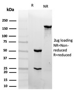 SDS-PAGE Analysis of Purified CD31 Mouse Monoclonal Antibody (PECAM1/4341). Confirmation of Integrity and Purity of Antibody.