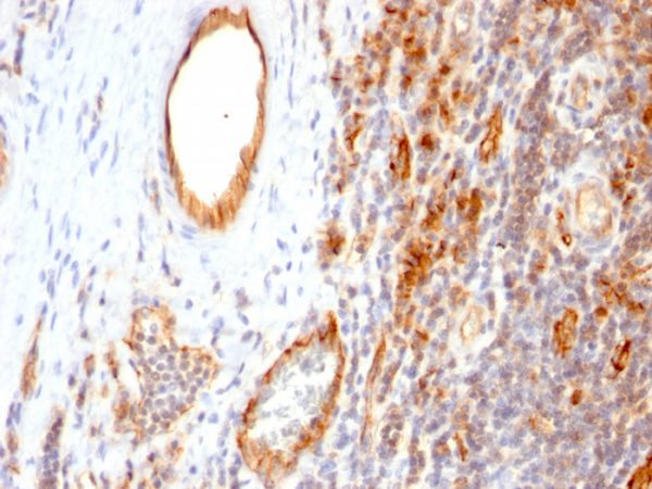 Formalin-fixed, paraffin-embedded human Tonsil stained with CD31 Monoclonal Antibody (1A10)