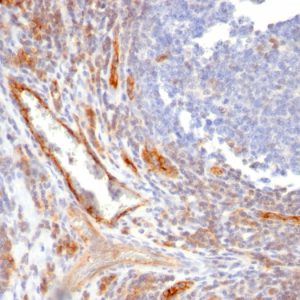 Formalin-fixed, paraffin-embedded human Tonsil stained with CD31 Mouse Monoclonal Antibody (C31.10).
