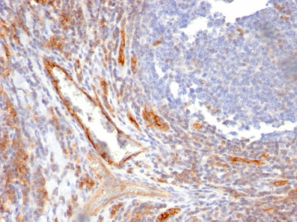 Formalin-fixed, paraffin-embedded human Tonsil stained with CD31 Mouse Monoclonal Antibody (C31.10).