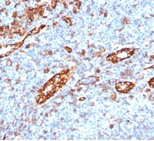 Formalin-fixed, paraffin-embedded human tonsil stained with CD31 Rabbit Recombinant Monoclonal Antibody (C31/6446R).
