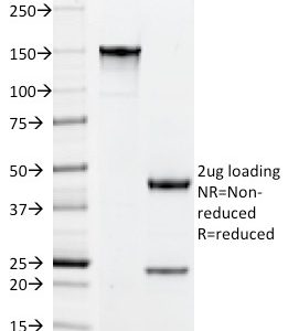 SDS-PAGE Analysis of Purified PLGF Monoclonal Antibody (PLGF/94). Confirmation of Integrity and Purity of Antibody