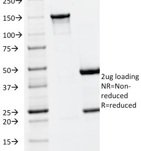 SDS-PAGE Analysis of Purified PLGF Monoclonal Antibody (PLGF/93). Confirmation of Integrity and Purity of Antibody.