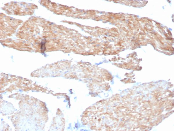 Formalin-fixed, paraffin-embedded human bladder stained with Aciculin Mouse Monoclonal Antibody (14F8/F8).