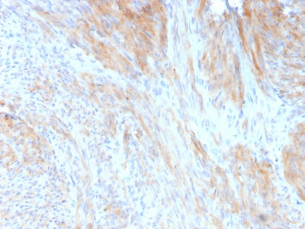 Formalin-fixed, paraffin-embedded human uterus stained with Aciculin Mouse Monoclonal Antibody (14F8/F8).
