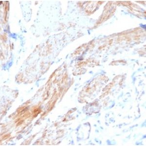 Formalin-fixed, paraffin-embedded human bladder stained with Aciculin Mouse Monoclonal Antibody (PGM5/3552) at 2ug/ml. HIER: Tris/EDTA, pH9.0, 45min. 2 °: HRP-polymer, 30min. DAB, 5min.