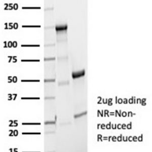SDS-PAGE Analysis Purified Aciculin Rabbit Monoclonal Antibody (PGM5/7005R). Confirmation of Purity and Integrity of Antibody.