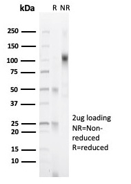 SDS-PAGE Analysis  Purified PR Recombinant Rabbit Monoclonal (PGR/6854R).  Confirmation of Integrity and Purity of Antibody.