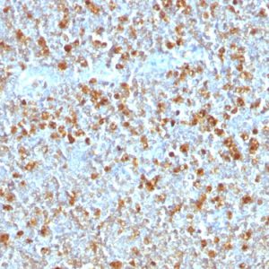 Formalin-fixed, paraffin-embedded human Tonsil stained with Alpha-1-Antitrypsin Mouse Monoclonal Antibody (AAT/1379).