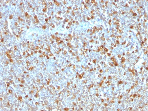 Formalin-fixed, paraffin-embedded human Tonsil stained with Alpha-1-Antitrypsin Mouse Monoclonal Antibody (AAT/1379).