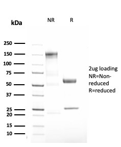 SDS-PAGE Analysis of Purified Alpha-1-Antitrypsin Recombinant Rabbit Monoclonal (AAT/3167R). Confirmation of Purity and Integrity of Antibody.