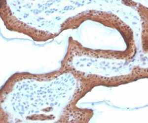 Formalin-fixed, paraffin-embedded human skin stained with SERPINB5 / Maspin Mouse Monoclonal Antibody (SERPINB5/4972). HIER: Tris/EDTA, pH9.0, 45min. 2°C: HRP-polymer, 30min. DAB, 5min