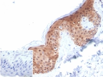 Formalin-fixed, paraffin-embedded human skin stained with SERPINB5 / Maspin Mouse Monoclonal Antibody (SERPINB5/4972). Inset: PBS instead of primary antibody; secondary only negative control.