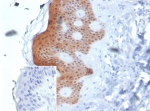 Formalin-fixed, paraffin-embedded human skin stained with SERPINB5 / Maspin Mouse Monoclonal Antibody (SERPINB5/4975). Inset: PBS instead of primary antibody; secondary only negative control.