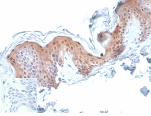 Formalin-fixed, paraffin-embedded human skin stained with SERPINB5 / Maspin Mouse Monoclonal Antibody (SERPINB5/4977). Inset: PBS instead of primary antibody; secondary only negative control.