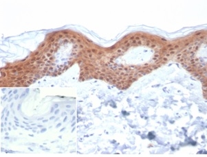 Formalin-fixed, paraffin-embedded human skin stained with SERPINB5 / Maspin Mouse Monoclonal Antibody (SERPINB5/4979). Inset: PBS instead of primary antibody; secondary only negative control.