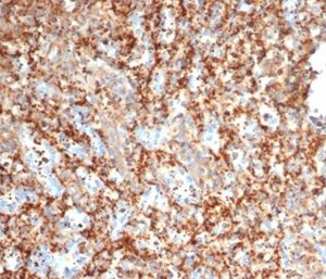 Formalin-fixed, paraffin-embedded human spleen stained with PIK3R2 Mouse Monoclonal Antibody (PIK3R2/292). HIER: Tris/EDTA, pH9.0, 45min. 2 °: HRP-polymer, 30min. DAB, 5min.