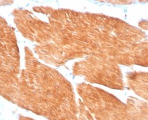 Formalin-fixed, paraffin-embedded human spleen stained with PIK3R2 Mouse Monoclonal Antibody (PIK3R2/1293). HIER: Tris/EDTA, pH9.0, 45min. 2°C: HRP-polymer, 30min. DAB, 5min.