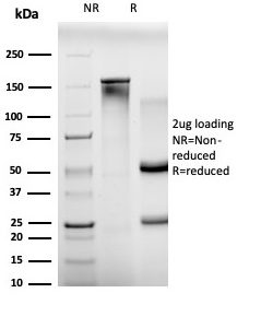 SDS-PAGE Analysis Purified BCL11A Mouse Monoclonal Antibody (PCRP-BCL11A-1H3). Confirmation of Integrity and Purity of Antibody.