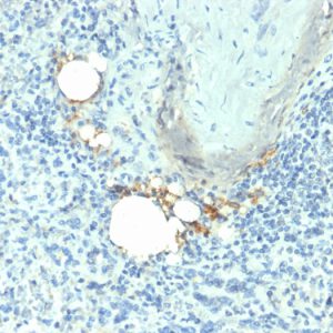 Formalin-fixed, paraffin-embedded human Spleen stained with TRAcP Mouse Monoclonal Antibody (ACP5/1070).