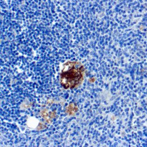 Formalin-fixed, paraffin-embedded human Spleen stained with TRAcP Monoclonal Antibody (SPM601).