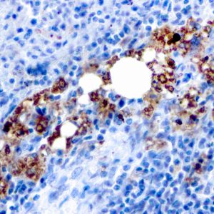 Formalin-fixed, paraffin-embedded human Spleen stained with TRAcP Mouse Recombinant Monoclonal Antibody (rACP5/1070).