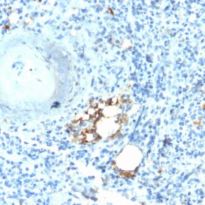 Formalin-fixed, paraffin-embedded human Spleen stained with TRAcP Rabbit Recombinant Monoclonal Antibody (ACP5/2336R).