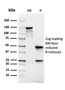 SDS-PAGE Analysis of Purified PODXL Recombinant Mouse Monoclonal Antibody (rPODXL/2184). Confirmation of Purity and Integrity of Antibody.