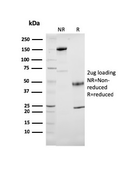 SDS-PAGE Analysis of Purified Cytochrome C Mouse Monoclonal Antibody (7H8.2C12). Confirmation of Purity and Integrity of Antibody.