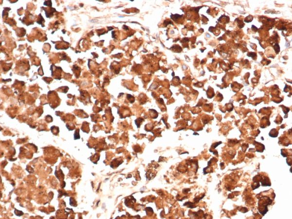 Formalin-fixed, paraffin-embedded human pituitary gland stained with ACTH Mouse Monoclonal Antibody (AH26).