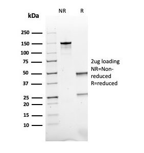 SDS-PAGE Analysis of Purified ACTH Mouse Recombinant Monoclonal Antibody (rCLIP/1407). Confirmation of Purity and Integrity of Antibody.