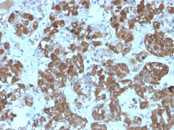 Formalin-fixed, paraffin-embedded human pituitary stained with ACTH Mouse Recombinant Monoclonal Antibody (rCLIP/1407).
