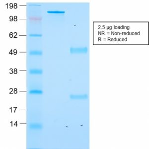 SDS-PAGE Analysis of Purified ACTH Recombinant Mouse Monoclonal Antibody (rCLIP/1418). Confirmation of Purity and Integrity of Antibody.