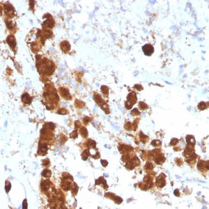 Formalin-fixed, paraffin-embedded human Pituitary stained with ACTH Monoclonal Antibody (SPM333).