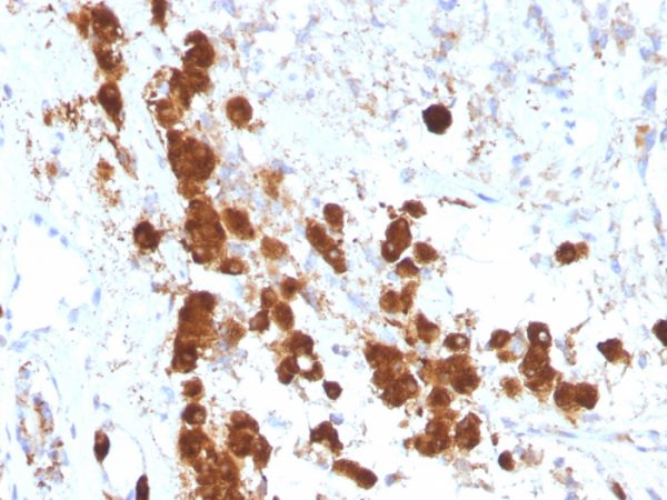 Formalin-fixed, paraffin-embedded human Pituitary stained with ACTH Monoclonal Antibody (SPM333).