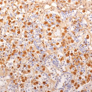 Formalin-fixed, paraffin-embedded human Pituitary Gland stained with ACTH Monoclonal Antibody (2F6).