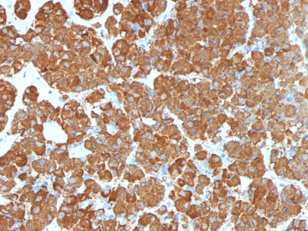 Formalin-fixed, paraffin-embedded human pituitary gland stained with ACTH Mouse Monoclonal Antibody (CLIP/1407).