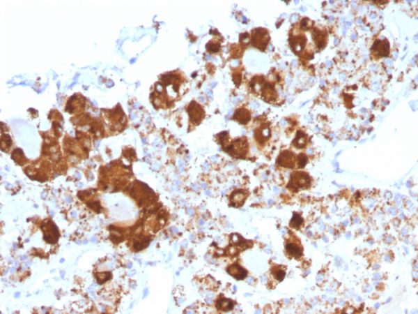 Formalin-fixed, paraffin-embedded human pituitary stained with ACTH Mouse Monoclonal Antibody (CLIP/1407).