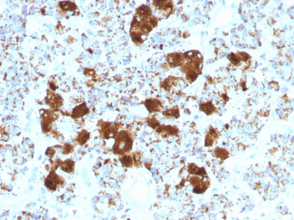 Formalin-fixed, paraffin-embedded human Pituitary stained with ACTH Monoclonal Antibody (SPM501).