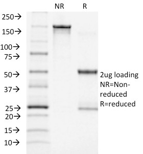 SDS-PAGE Analysis Purified ACTH Monoclonal Antibody (CLIP/1418). Confirmation of Integrity and Purity of Antibody.