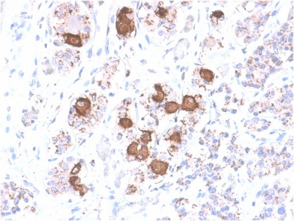 Formalin-fixed, paraffin-embedded human Pituitary stained with ACTH Rabbit Recombinant Monoclonal Antibody (CLIP/2040R).