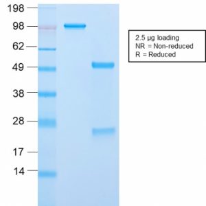 SDS-PAGE Analysis of Purified ACTH Rabbit Recombinant Monoclonal Antibody (CLIP/2859R). Confirmation of Purity and Integrity of Antibody.