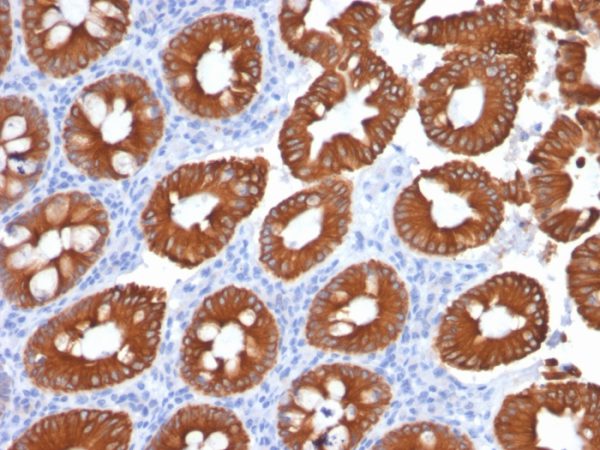 Formalin-fixed, paraffin-embedded human Normal Colon stained with Cytokeratin 20 (KRT20) Mouse Monoclonal Antibody (KRT20/1991).
