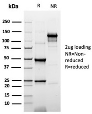 SDS-PAGE Analysis of Purified KRT20 Recombinant Mouse Monoclonal Antibody (rKRT20/6536). Confirmation of Purity and Integrity of Antibody.