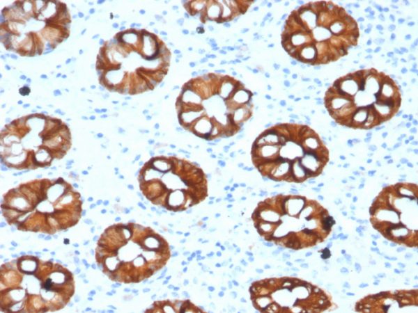 Formalin-fixed, paraffin-embedded human Normal Colon stained with Cytokeratin 20 (KRT20) Mouse Monoclonal Antibody (KRT20/1993).